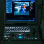 Ultraschalldiagnostik | Das Gefäßzentrum am Rudolfplatz